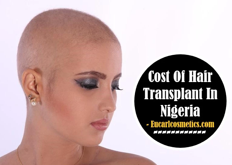 Cost Of Hair Transplant In Nigeria (2022)
