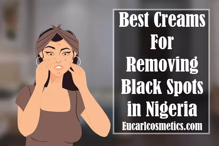 Best Creams For Removing Black Spots in Nigeria